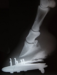 Laminitis, Rotation of the Coffin Bone