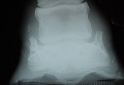 Sidebone XRay