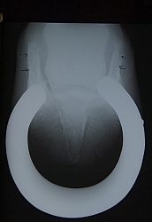 Sidebone XRay