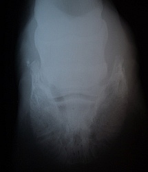 Sidebone XRay