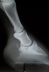 Navicular Xray