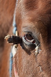 Removal of Stick From Eye