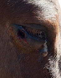 Removal of Stick From Eye
