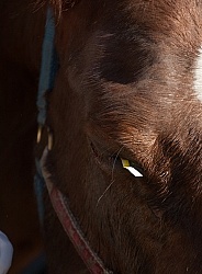 Removal of Stick From Eye