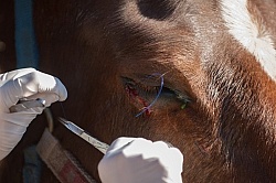 Removal of Stick From Eye