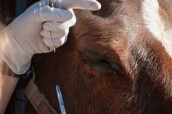 Removal of Stick From Eye