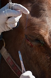 Removal of Stick From Eye