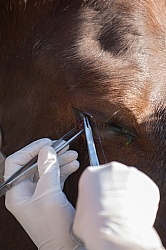 Removal of Stick From Eye