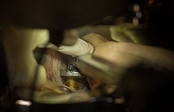 Equine Dentistry - Teeth Flaoting