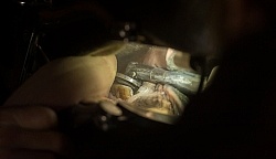 Equine Dentistry - Teeth Flaoting