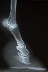 Laminitis, Rotation of the Coffin Bone Laminitis Xray
