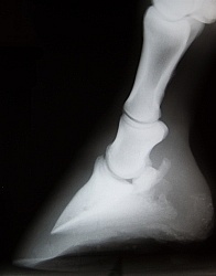 Navicular Xray Navicular Xray