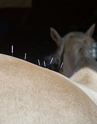 Acupuncture