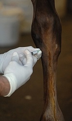 Joint Injection Joint Injections