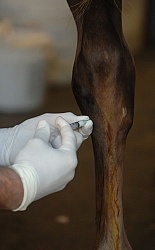 Joint Injection Joint Injections