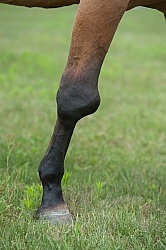 Calcification on the knee