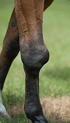 Calcification on the knee