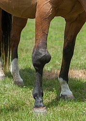 Calcification on the knee