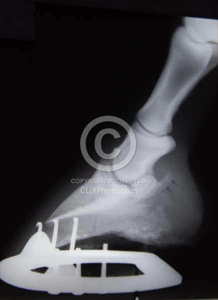 Navicular Xray