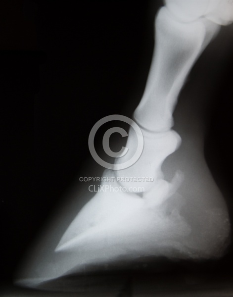 Navicular Xray