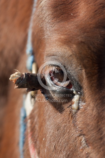 Removal of Stick From Eye