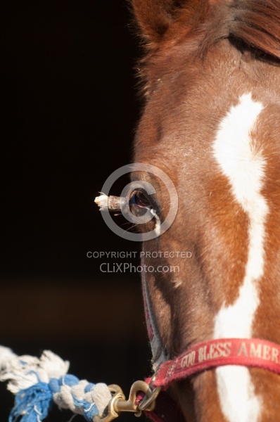 Removal of Stick From Eye