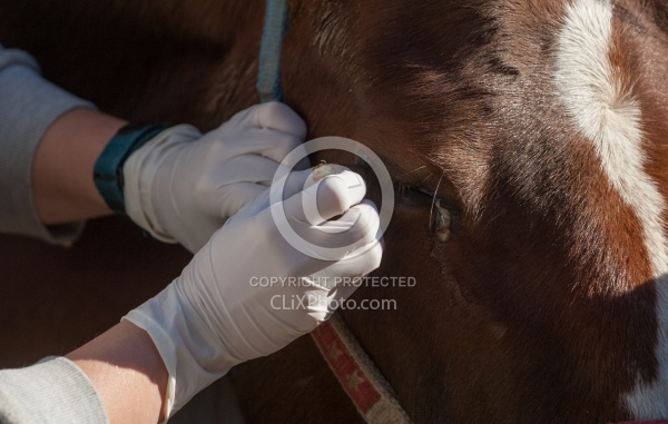 Removal of Stick From Eye