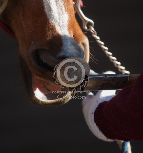 Removal of Stick From Eye