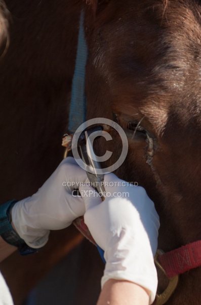 Removal of Stick From Eye