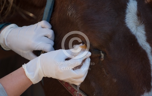 Removal of Stick From Eye