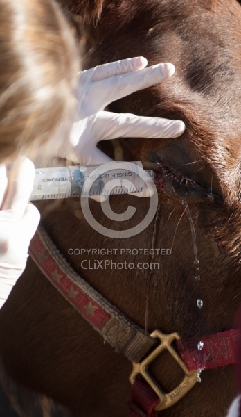 Removal of Stick From Eye