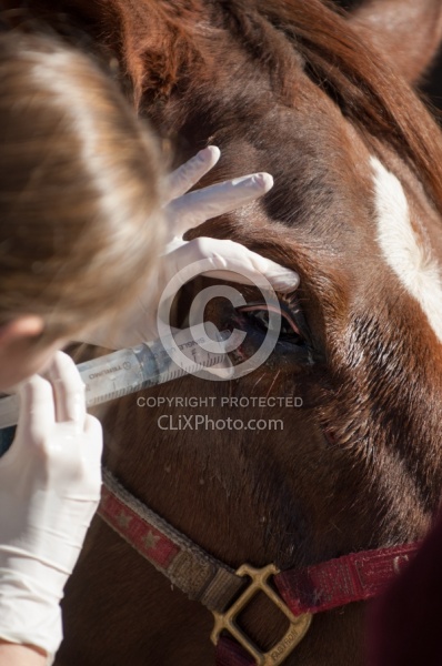 Removal of Stick From Eye
