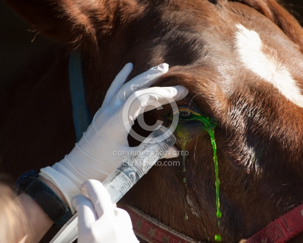 Removal of Stick From Eye