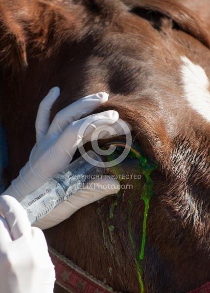 Removal of Stick From Eye