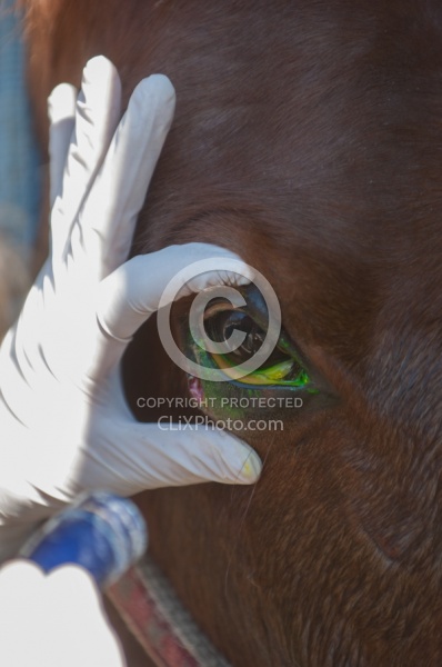 Removal of Stick From Eye