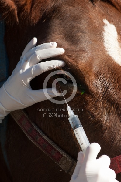 Removal of Stick From Eye