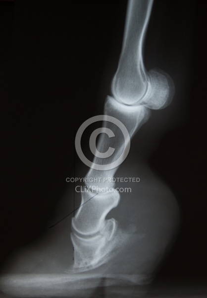 Laminitis, Rotation of the Coffin Bone Laminitis Xray