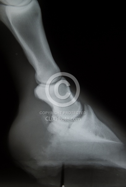 Navicular Xray Navicular Xray