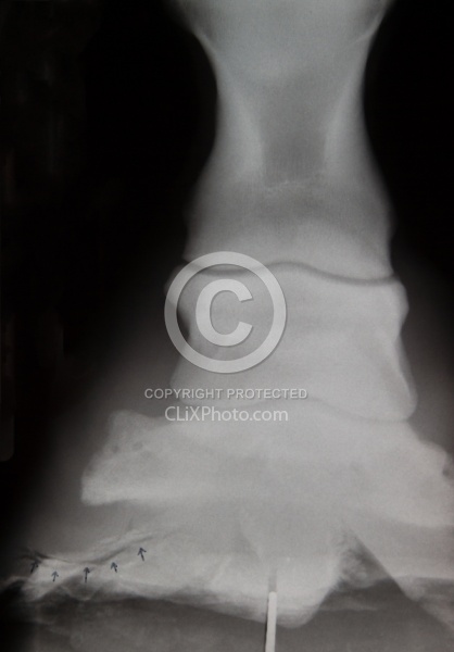 Hoof Abscess X-Ray Foot Abscess Xrays