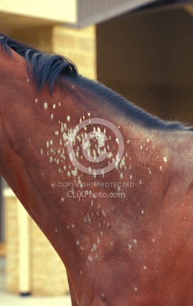 Skin Irritation, fungus