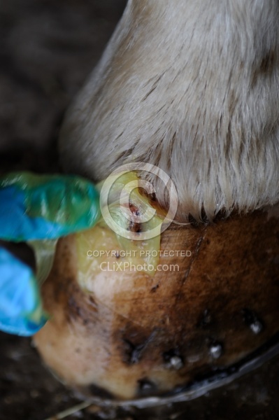 Applying Topical Antibiotic Cream to Wound