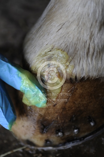 Applying Topical Antibiotic Cream to Wound