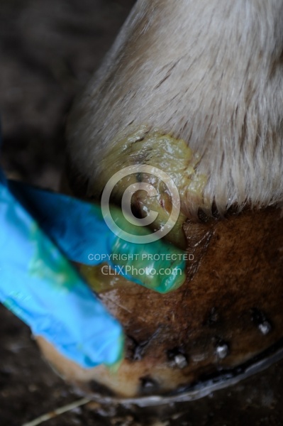 Applying Topical Antibiotic Cream to Wound