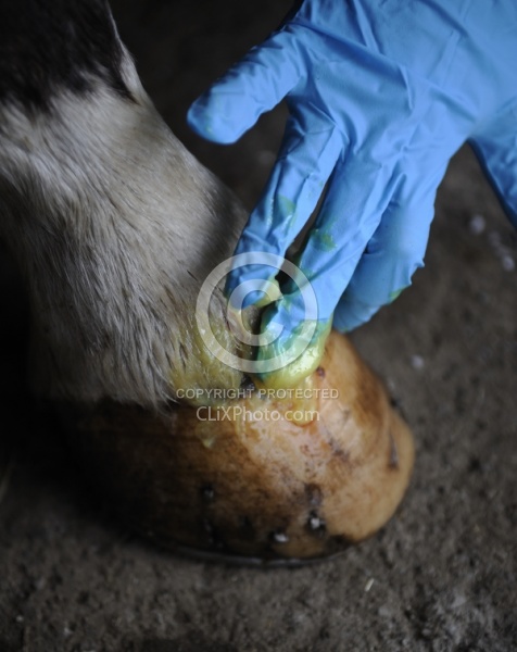 Applying Topical Antibiotic Cream to Wound