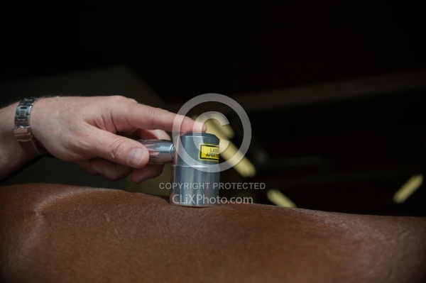 Laser Therapy to Back