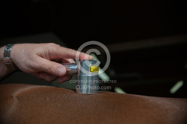 Laser Therapy to Back