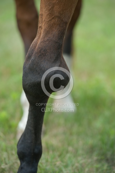 Calcification on the knee