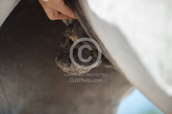 Mlanoma in the Sheath